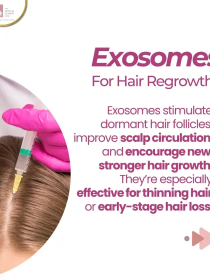 Exosomes are at the forefront of hair regrowth science. This treatment uses tiny messengers to stimulate dormant hair follicles and improve scalp circulation. It is particularly effective for tackling thinning hair or the early stages of hair loss.