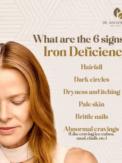 Iron deficiency can manifest in various ways that affect your skin, hair, and nails. This graphic outlines six key signs, including hair fall, dark circles, and brittle nails, that may indicate a need for medical evaluation and dietary changes.