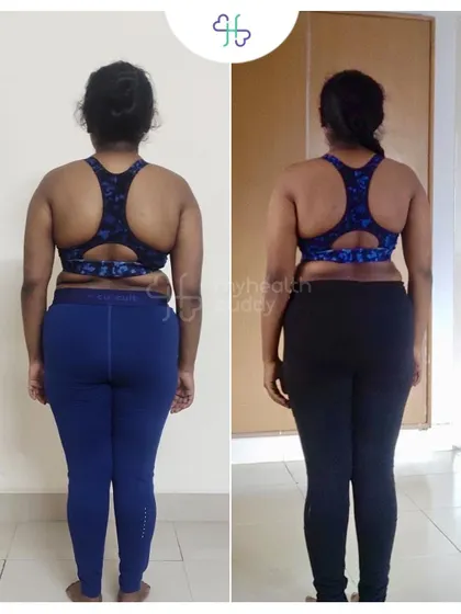Back view showing a more toned and stronger back. Her transformation is truly inspiring.
