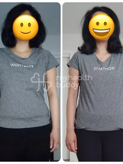 A front view of the same 7kg transformation, showing a clear change in body composition and a healthier look.