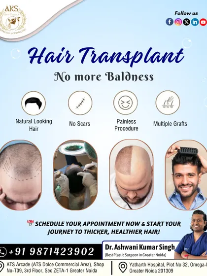 This provides a quick summary of what you can expect from my hair transplant service. I focus on creating a natural look with a painless procedure that leaves no scars, using multiple grafts to achieve the desired density.