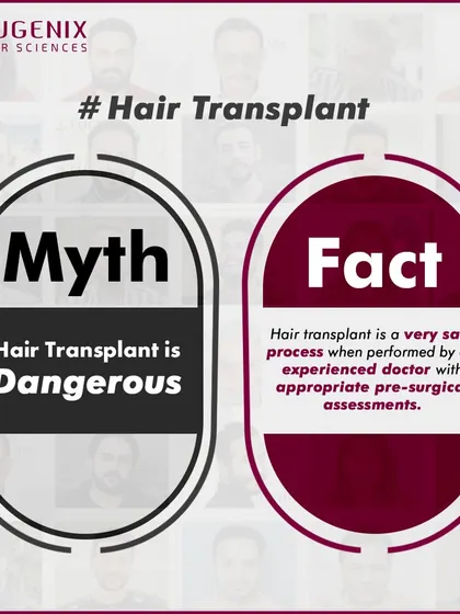 We tackle the biggest myths head-on: hair transplants are painful, only for celebrities, look fake, are dangerous, or are better done abroad.