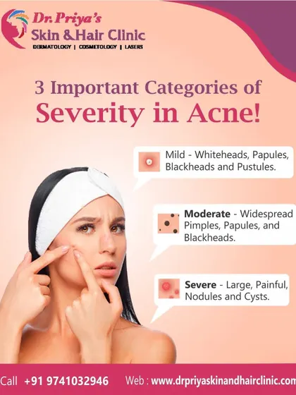 Acne presents with varying levels of severity, from mild whiteheads to severe, painful cysts. Correctly identifying the category of acne is the first step in creating a treatment plan that effectively addresses the condition.
