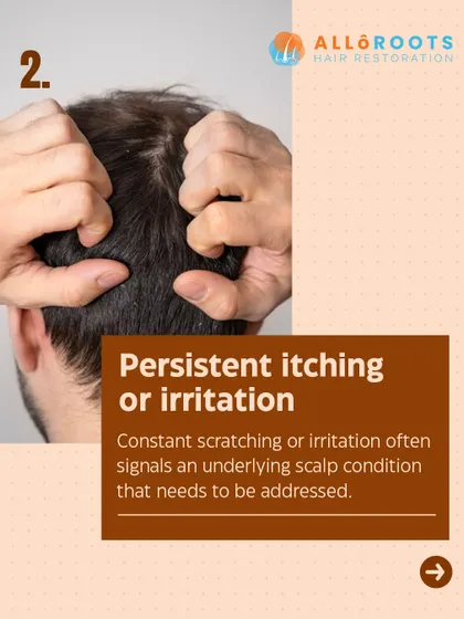 Do not ignore a persistently itchy or irritated scalp. This is often a signal of an underlying condition, such as a fungal issue or inflammation, that needs to be properly diagnosed and addressed.