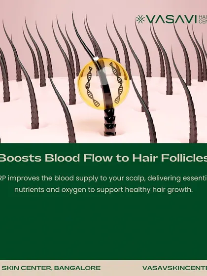 This animation shows how PRP boosts blood flow to the hair follicles. By improving the supply of oxygen and essential nutrients to the scalp, the treatment creates a healthier environment for hair to grow.