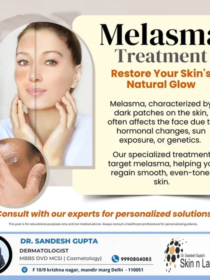 This graphic explains that melasma is characterized by dark patches on the face. My specialized treatments target this condition to help you regain smooth, even-toned skin and restore your natural glow.