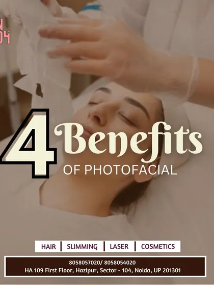 Here are four key benefits of a Photofacial treatment. It's one of our most effective services for tackling multiple concerns at once, from sun damage to signs of aging, revealing a healthier complexion.