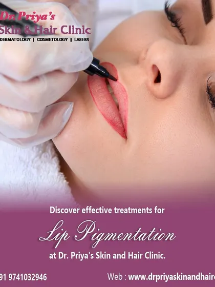Lip pigmentation is a common concern that I treat with various effective methods in my clinic. Based on the cause and depth of the pigment, I design a personalized plan to restore the natural color of the lips.