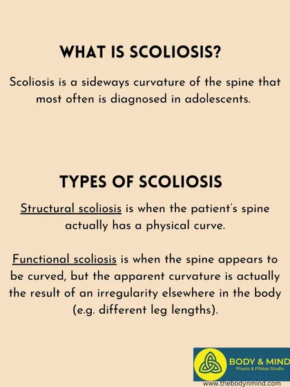 A repeat of the scoliosis types infographic for emphasis.