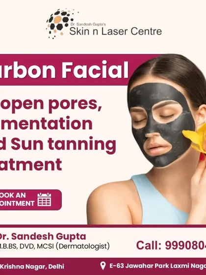 This is an advertisement for the Carbon Facial treatment I offer. It is a non-invasive procedure that helps to exfoliate the skin, reduce pigmentation, and minimize pores, leaving your skin refreshed and clear.