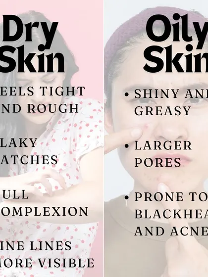A simple comparison: dry skin often feels tight and rough with a dull complexion, while oily skin is shiny with larger pores and is prone to blackheads.