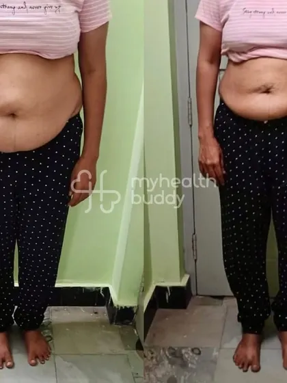 Front view of the teacher's transformation, showing a flatter stomach and leaner physique.