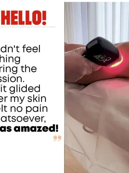 The most common feedback we receive is surprise at how comfortable the process is. Thanks to the advanced cooling technology of our Alma Soprano machine, our clients experience a truly pain-free session every time.