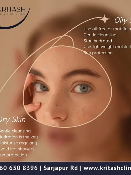 Understanding your skin is the first step to caring for it properly. This graphic contrasts the needs of oily skin, which requires lightweight products and gentle cleansing, with dry skin, which needs rich hydration and protection from moisture loss.