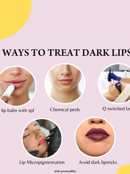Treating dark lips requires a multi-faceted approach. I recommend five key strategies: using a lip balm with SPF, undergoing in-clinic chemical peels or Q-switched laser sessions, considering lip micropigmentation for temporary color, and avoiding dark lipsticks that can contribute to pigmentation.