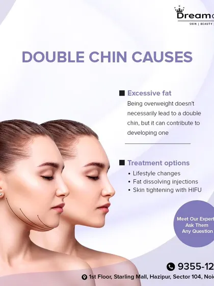 A double chin can be caused by various factors, and I offer multiple treatment options, including fat-dissolving injections and skin tightening with HIFU, to address it effectively.