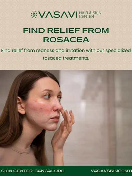 Rosacea is a common condition that causes redness and irritation. You do not have to live with the discomfort. I offer specialized, gentle treatments designed to soothe the skin, calm inflammation, and restore your natural, even complexion.
