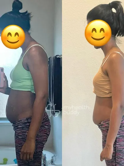 Side view of her postpartum transformation. She looks stronger, leaner, and more confident.