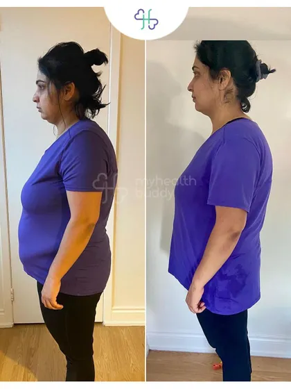 Side view of her incredible 10 kg weight loss. She embraced the process and made it a lifestyle.