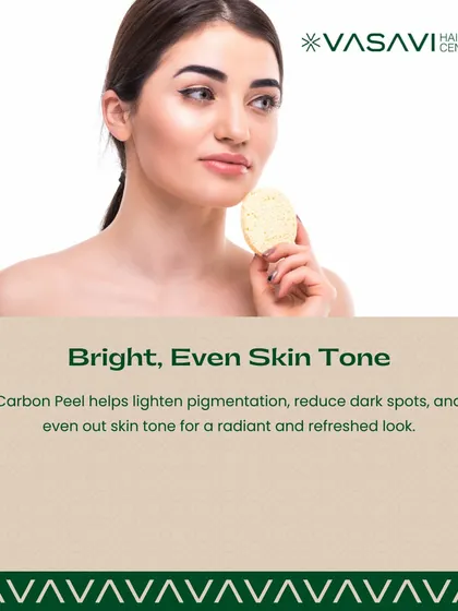 For those struggling with post-acne marks, the Carbon Peel helps lighten pigmentation and reduce dark spots. It evens out skin tone for a radiant and refreshed look.