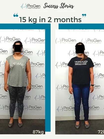 Another fantastic result: 15 kg lost in just two months. This client's journey from 87 kg to 72 kg is a powerful example of fat-focused weight loss.