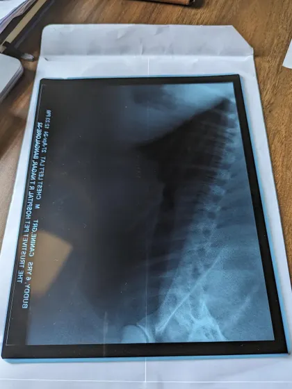 A photo of Buddy's X-ray film. We had to raise Rs. 13,000 to cover all these initial tests.