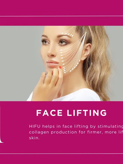 HIFU is an excellent treatment for non-surgical face lifting. The ultrasound energy stimulates your skin's deep structural layers to produce more collagen, resulting in firmer, more lifted skin over time.