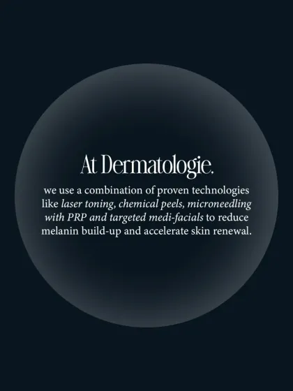 At my clinic, we use a combination of proven technologies like laser toning, chemical peels, and microneedling with PRP to reduce melanin buildup and accelerate skin renewal for pigmentation concerns.