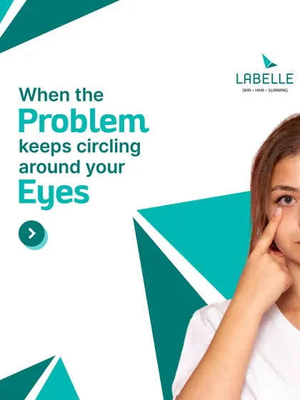 Dark circles can be caused by stress, lack of sleep, or other factors. We use advanced technology and our 24 years of expertise to effectively treat and remove them.