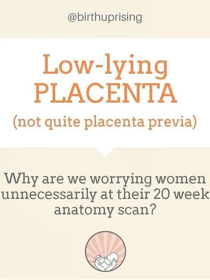 A diagnosis of "low-lying placenta" at 20 weeks can cause unnecessary worry. In over 98% of cases, the placenta "migrates" up and away from the cervix as the uterus grows, resolving the issue on its own before birth.
