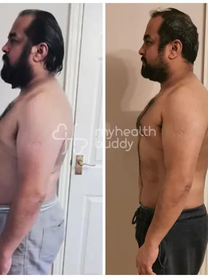 Side view of Vikas's 8kg transformation.