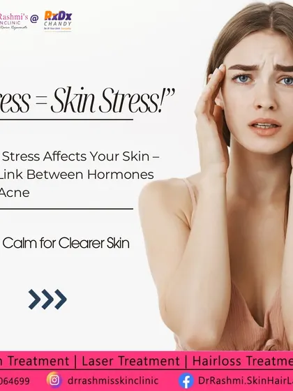 Stress directly impacts your skin, a connection I often discuss with my patients. This graphic introduces the concept of "skin stress," explaining how hormones and inflammation triggered by stress can lead to acne and other concerns.