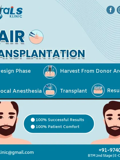 This infographic breaks down our hair transplantation process into five key phases: Design, Harvest, Local Anesthesia, Transplant, and Result. We focus on ensuring 100% patient comfort throughout the procedure while aiming for successful, natural outcomes.