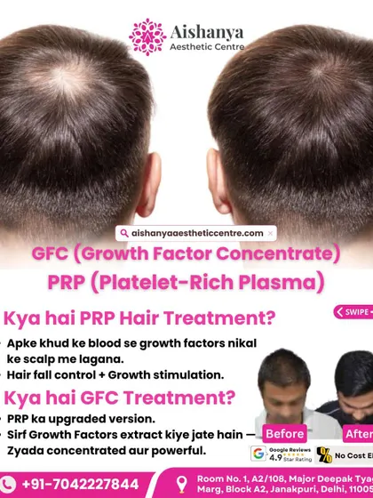 What is the difference between GFC and PRP? I explain how GFC is the upgraded, more powerful version of the trusted PRP treatment, offering more concentrated growth factors for better and faster results.