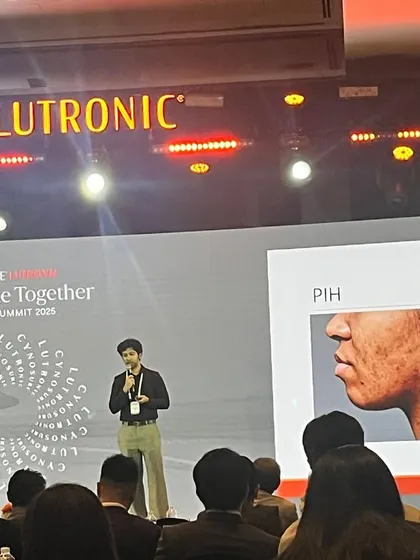 I was honored to speak at the Cynosure Lutronic APAC Summit 2025. Sharing my clinical experience on using Q-switched lasers for treating pigmentation issues in Indian skin with my peers is a vital part of advancing our collective knowledge and improving patient outcomes.