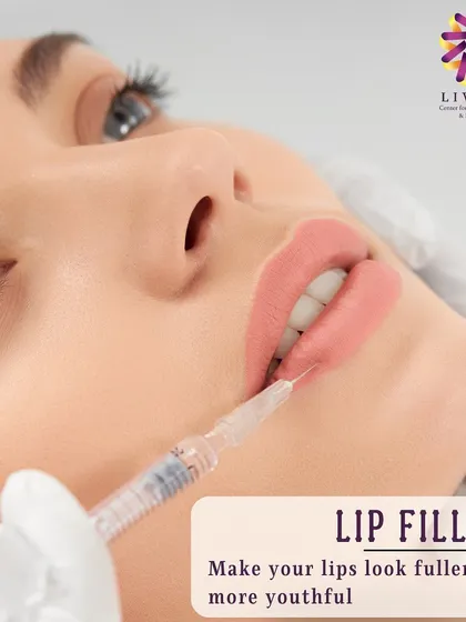 Lip fillers are a popular choice for adding volume and definition. This image shows the precision involved in the procedure, which I use to enhance the natural shape of the lips for a fuller, more balanced look.