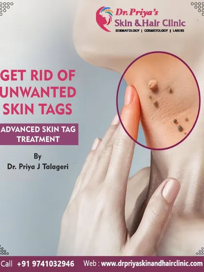 This is an overview of my advanced skin tag treatment. Using methods like radio frequency, I can remove unwanted skin tags from areas like the neck and underarms with high precision and minimal discomfort.