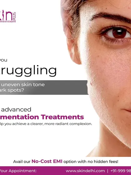 This graphic targets clients struggling with uneven skin tone or dark spots. It presents my advanced pigmentation treatments as the solution for achieving a clearer, more radiant complexion.