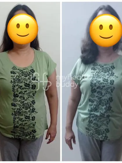Front view of the 3kg transformation.