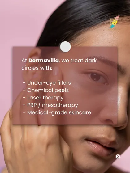 At my clinic, I treat dark circles with a multi-pronged approach. This can include under-eye fillers for volume loss, chemical peels or laser for pigmentation, and medical-grade skincare to support skin health.