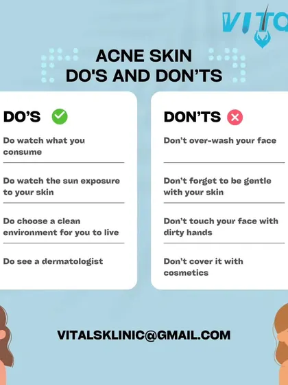 Following a few key principles can make a significant difference in managing acne. This guide outlines essential dos, like seeing a dermatologist and protecting your skin from the sun, and don'ts, like over-washing or touching your face with dirty hands.
