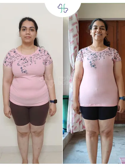 Front view of her 4 kg weight loss. Her smile shows her newfound confidence.