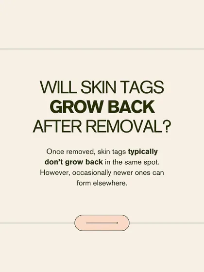 Will skin tags grow back after removal? Typically, they do not grow back in the same spot. However, new ones can occasionally form elsewhere, especially if you are prone to them.