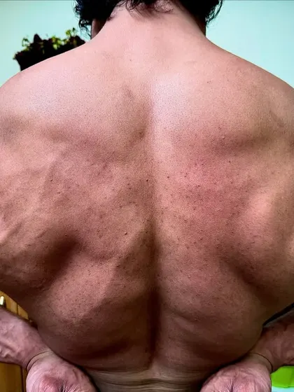 Another angle of my back development. The definition and vascularity you see here are a direct result of a disciplined approach to both lifting and nutrition.