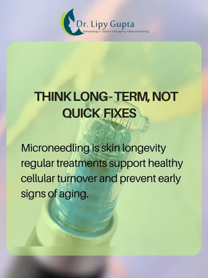 Think of microneedling as an investment in skin longevity, not a quick fix. Regular treatments support healthy cellular turnover and prevent premature aging.