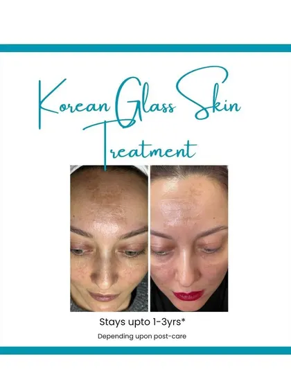 This graphic shows a clear before-and-after, emphasizing that the radiant results of the Korean Glass Skin treatment can last for up to 1-3 years.