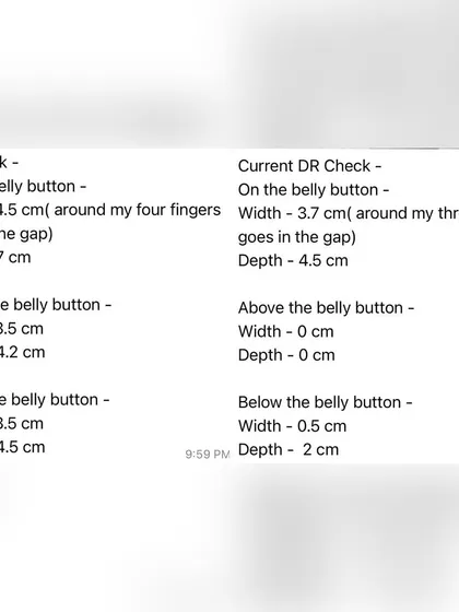This is proof that you can heal Diastasis Recti. This client's DR check shows a significant reduction in the gap's width and depth after just 12 weeks of targeted exercises and a consistent plan.