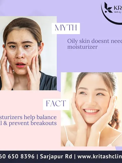 It is a fact that oily skin requires a moisturizer. When your skin is dehydrated, it compensates by producing even more oil. Using a lightweight, oil-free moisturizer helps maintain a healthy skin barrier and can reduce breakouts.