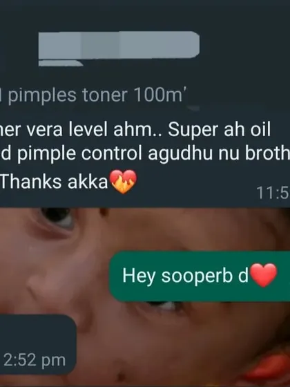 "Akka.. Toner vera level ahm.. Super ah oil control and pimple control agudhu". This message from a customer about my Tea Tree Toner made me so happy. Thank you for sharing this, akka.