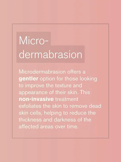 Microdermabrasion offers a gentler, non-invasive option for Acanthosis Nigricans. It exfoliates the skin to reduce the thickness and darkness of the affected areas over time.